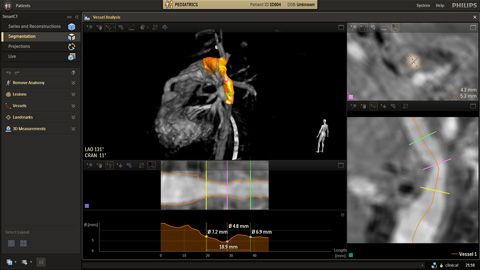 Flujo de trabajo de radiología flexible